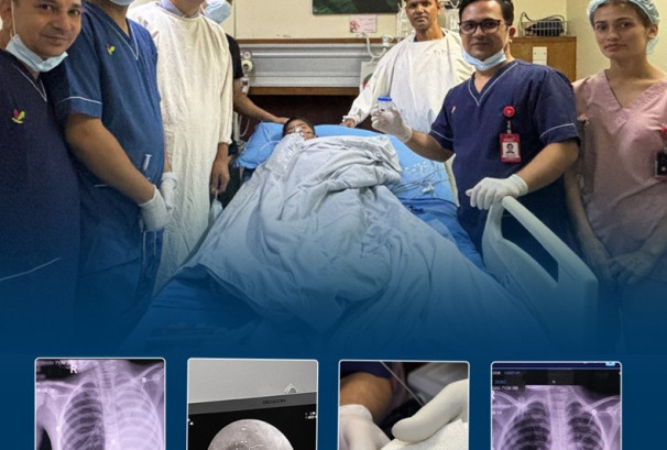 फोक्सोको देब्रेतर्फको श्वासनलीमा इमलीको दाना अड्किएका बालकको नर्भिक इन्टरनेशनल हस्पिटलमा सफल उपचार