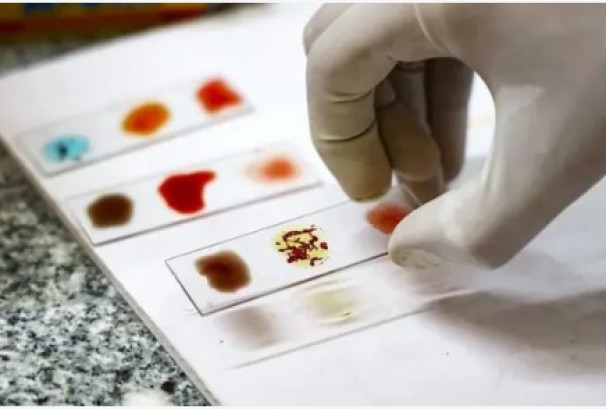 'गोल्डन ब्लड' समूह के हो? वैज्ञानिकहरूले ल्याबमा तयार पार्ने प्रयासमा, दुर्लभ रोगीहरूका लागि वरदान बन्न सक्छ!