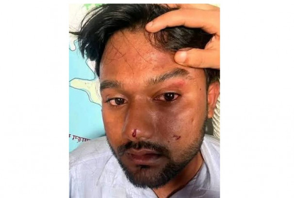अस्पतालबाट जेनजी अभियन्ता माजिदको अपिल, ‘मेरो जीवन तथा व्यक्तिगत स्वतन्त्रताको सुरक्षा सुनिश्चित गरियोस्’