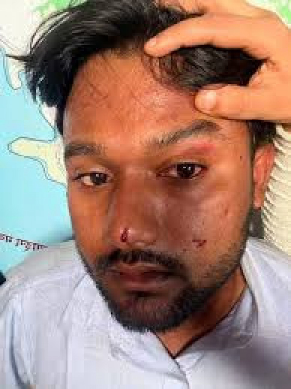 माजिद अन्सारीमाथि कुटपिट प्रकरणमा मानव अधिकार आयोगमा उजुरी
