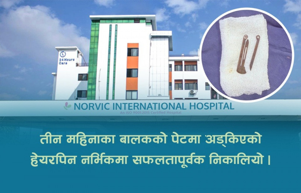 तीन महिनाका बालकको पेटमा अड्किएको हेयरपिन नर्भिकमा सफलतापूर्वक निकालियो